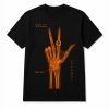 Jalen Brunson Wrist Surgery X-ray Shirt
