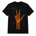 Jalen Brunson Wrist Surgery X-ray Shirt